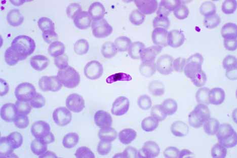 violet colored microscopic image of a malaria parasite